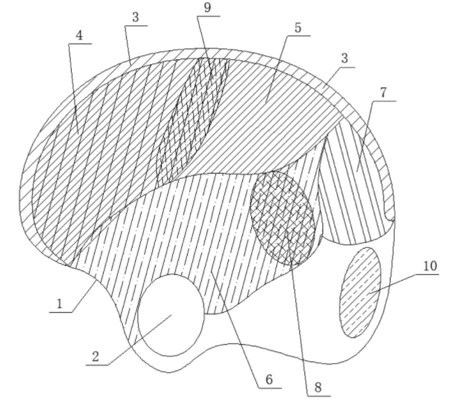 /uploads/image/2025/08/28/b30a6bdd1de4c08521d2edae07dd5879.png 图片一种用于经颅磁刺激法的定位帽以及基于定位帽的经颅磁刺激法.png